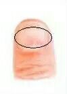 指甲上有竖纹，是身体有大病的征兆吗