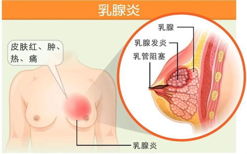 如何处理胸片曝光不足的问题